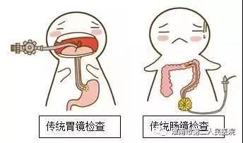 胃镜